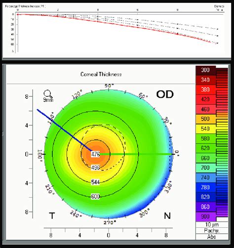 measuring corneal thickness|average corneal thickness range.